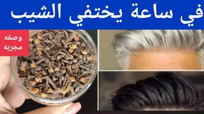 وصفة القرنفل للتخلص من الشيب والشعر الأبيض بشكل