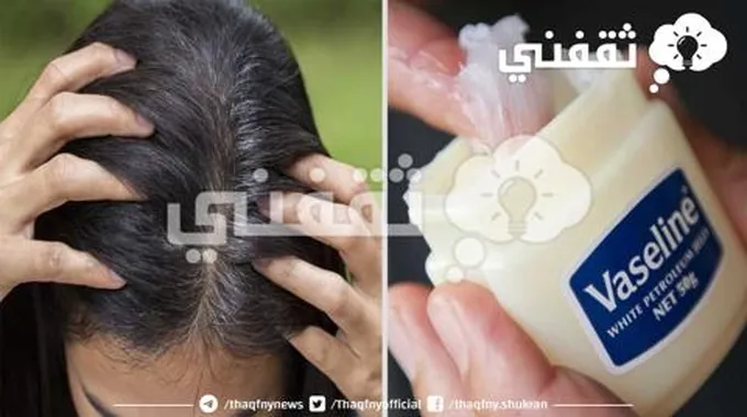 بدوري على حل لعلاج الشيب المبكر بدون رجعة هاتي