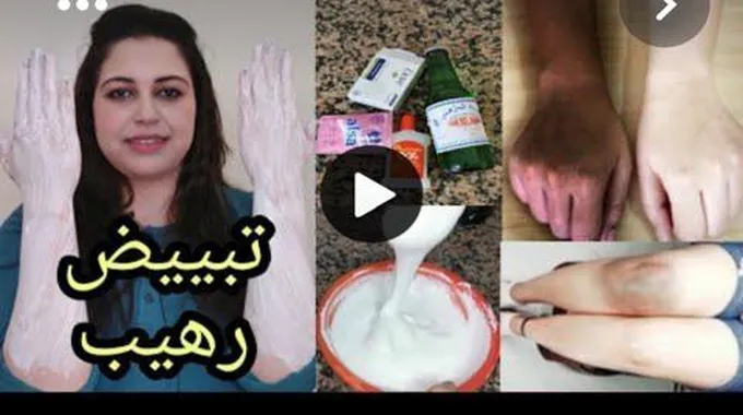 هاتي الشبه وتعالي اقولك وصفة لتبييض الوجه