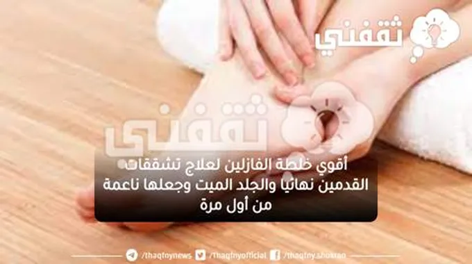 أقوي خلطة الفازلين لعلاج تشققات القدمين نهائيا