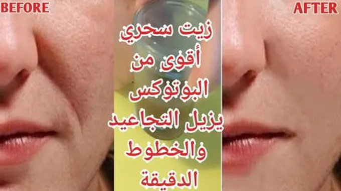 زيت الضرو لمكافحة التجاعيد هيمسح التجاعيد من