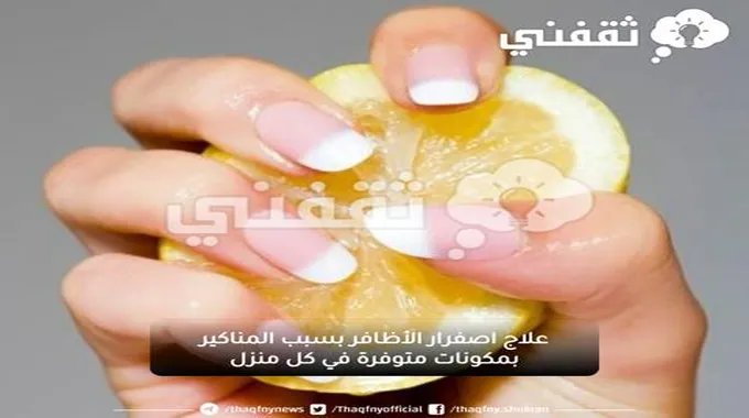 علاج اصفرار الأظافر بسبب المناكير بمكونات