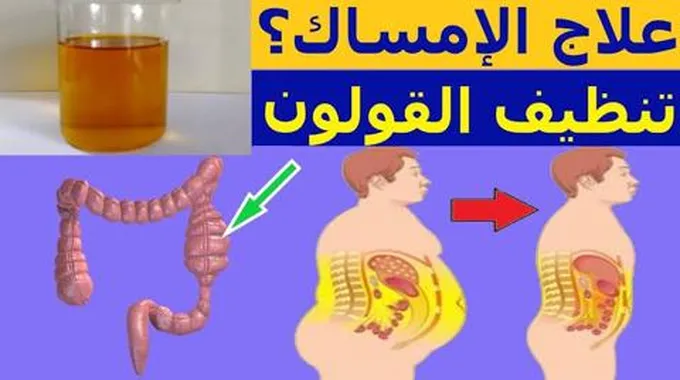 أقوى وأسرع علاج فعال للإمساك المزمن وكيفية