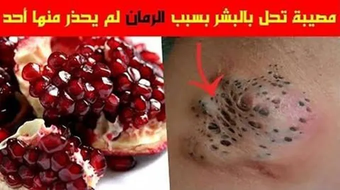 خطير جدا.. كارثة صحية بسبب الرمان لم ينتبه لها