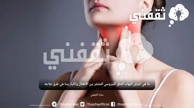 ما هي أعرض التهاب الحلق الفيروسي المنتشر بين