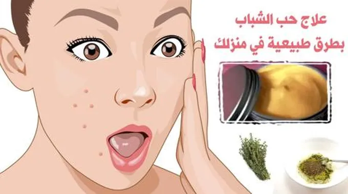 ماسك للتخلص من حبوب الوجه بالمكونات الطبيعية