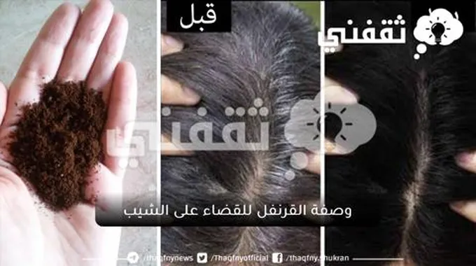 وصفة القرنفل للقضاء على الشيب وأسباب ظهوره في